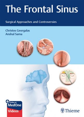 The Frontal Sinus Surgical Approaches and Controversies
