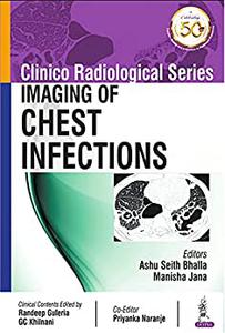 Clinico Radiological Series Imaging of Chest Infections