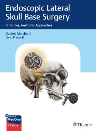 Endoscopic Lateral Skull Base Surgery Principles, Anatomy, Approaches