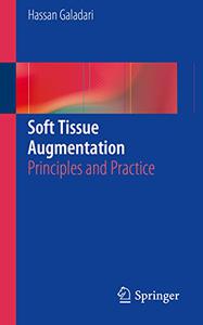 Soft Tissue Augmentation Principles and Practice