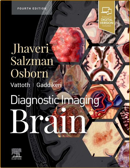 Jhaveri M  Diagnostic Imaging  Brain 4ed 2021