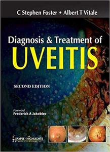 Diagnosis and Treatment of Uveitis Ed 2