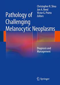 Pathology of Challenging Melanocytic Neoplasms Diagnosis and Management 