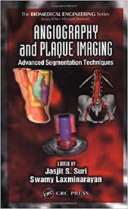 Angiography and Plaque Imaging Advanced Segmentation Techniques (Biomedical Engineering)