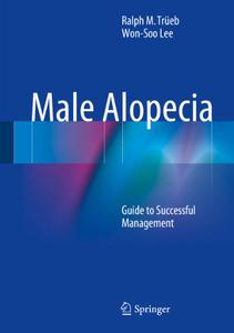 Male Alopecia Guide to Successful Management