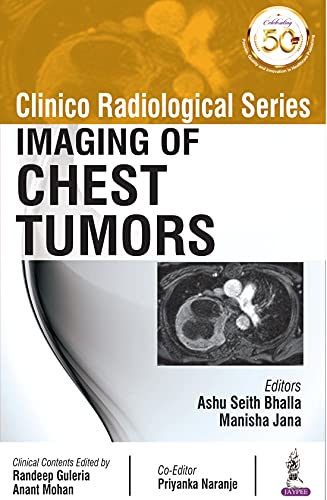 Clinico Radiological Series Imaging Of Chest Tumors 1st Edition