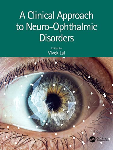 A Clinical Approach to Neuro Ophthalmic Disorders