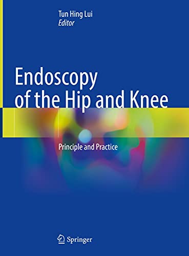 Endoscopy of the Hip and Knee: Principle and Practice (EPUB)