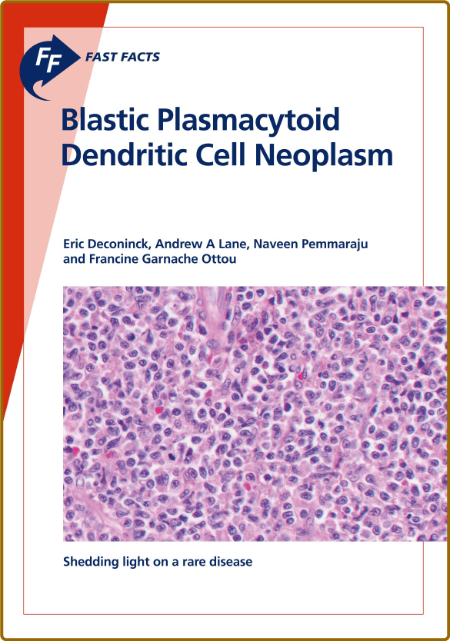  Fast Facts - Blastic Plasmacytoid Dendritic Cell Neoplasm - Shedding Light on a R...