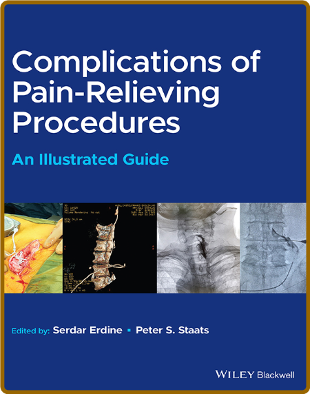  Complications of Pain-Relieving Procedures - An Illustrated Guide (True )
