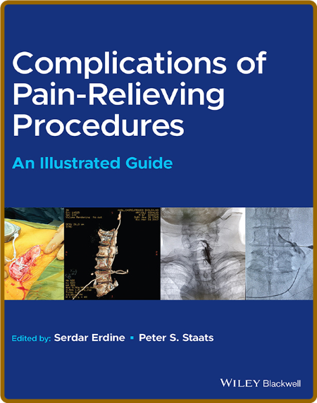  Complications of Pain-Relieving Procedures - An Illustrated Guide (True ) B6b96bb56db5d0a4c1b2e9d055af6e86