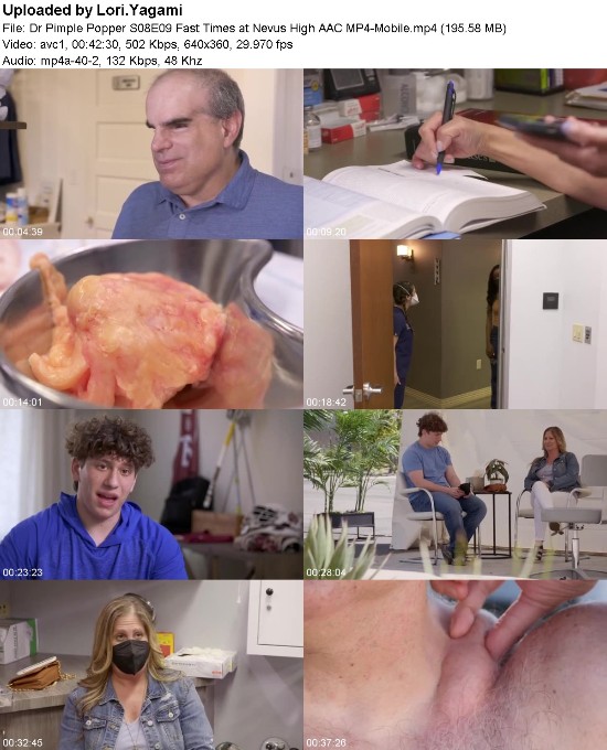 Dr Pimple Popper S08E09 Fast Times at Nevus High AAC MP4-Mobile