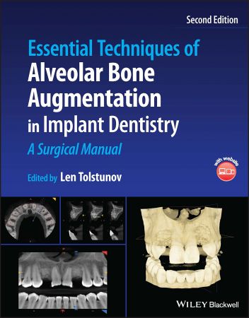 Essential Techniques of Alveolar Bone Augmentation in Implant Dentistry A Surgical Manual, 2nd Edition