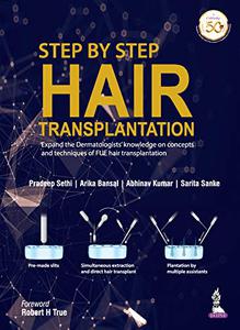 Step by Step Hair Transplantation