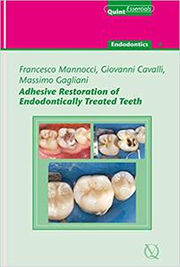 Adhesive Restoration of Endodontically Treated Teeth Endodontics 4