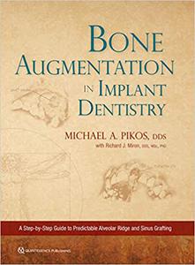 Bone Augmentation in Implant Dentistry A Step-by-Step Guide to Predictable Alveolar Ridge and Sinus Grafting 
