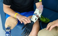 Во Львове впервые установили бойцу ВСУ бионическую руку