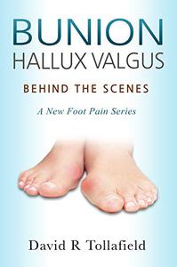 Bunion (Hallux valgus) Behind the Scenes Foot Pain Series (Reflective Podiatric Practice)