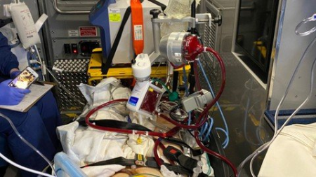 Ecmo : In Hospital And Transport