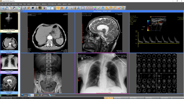 download the new Sante DICOM Viewer Pro 12.2.5