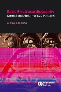 Basic Electrocardiography Normal and Abnormal ECG Patterns