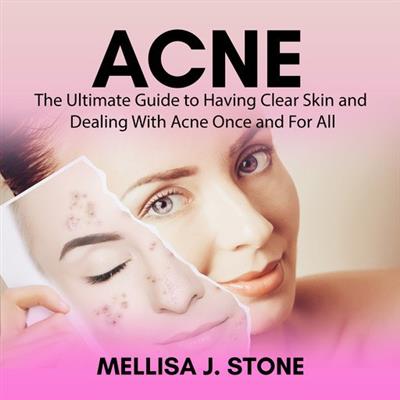 Acne The Ultimate Guide to Having Clear Skin and Dealing With Acne Once and For Al