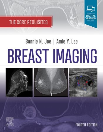 Breast Imaging The Core Requisites, 4th Edition