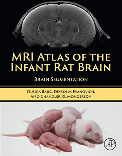 MRI Atlas of the Infant Rat Brain Brain Segmentation