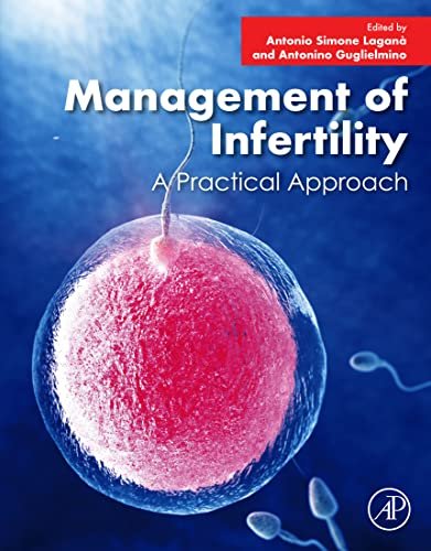 Management of Infertility A Practical Approach