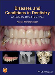 Diseases and Conditions in Dentistry An Evidence-Based Reference