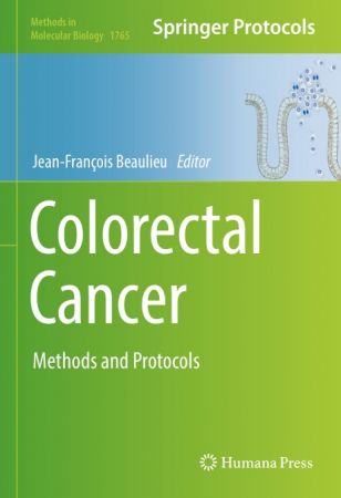 Colorectal Cancer: Methods and Protocols