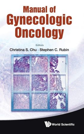 Manual Of Gynecologic Oncology