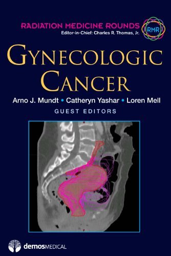 Gynecologic Cancer (Radiation Medicine Rounds Book 2)