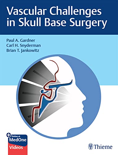 Vascular Challenges in Skull Base Surgery (True PDF, EPUB)