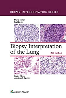 Biopsy Interpretation of the Lung, 2nd Edition
