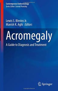 Acromegaly A Guide to Diagnosis and Treatment (Contemporary Endocrinology)