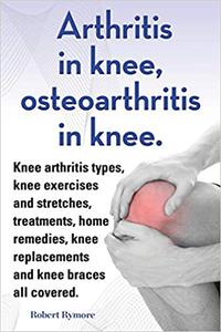 Arthritis in knee, osteoarthritis in knee