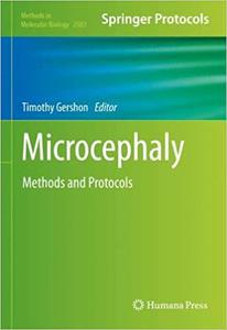 Microcephaly Methods and Protocols