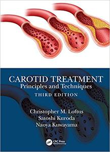 Carotid Treatment Principles and Techniques, 3rd Edition