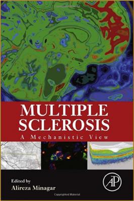 Minagar A  Multiple Sclerosis  A Mechanistic View 2016