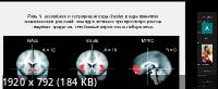 Мозг: дофамин, движение и новизна (2022/PCRec/Rus)
